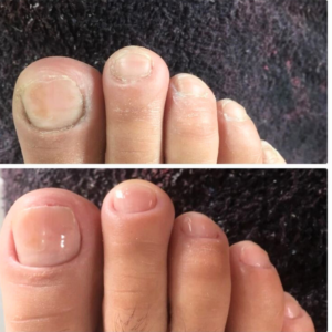 pedicure_vietnamita_chile